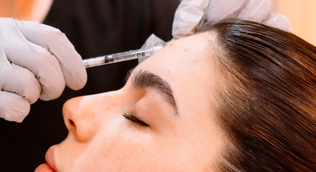 Aplicación de toxina botulínica en la frente